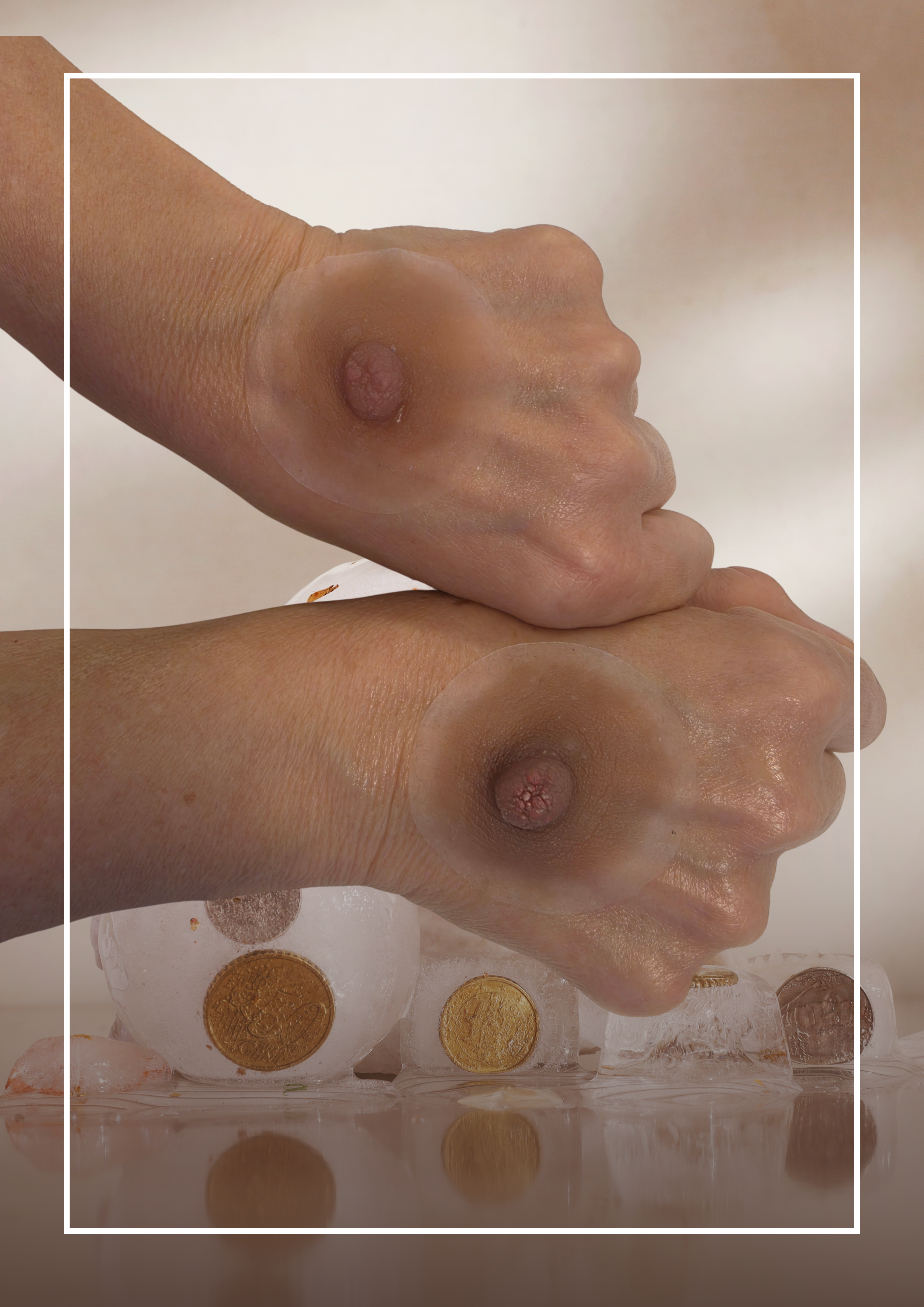 3D Areola Prothetik aus Silikon